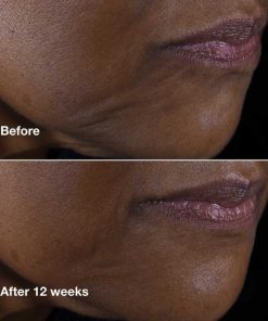 Clinique Smart Clinical Repair Anti Aging Lifting Face, Neck Cream with Peptides, Hyaluronic Acid For All Skin Types, Hydrating