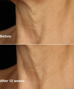 Clinique Smart Clinical Repair Anti Aging Lifting Face, Neck Cream with Peptides, Hyaluronic Acid For All Skin Types, Hydrating