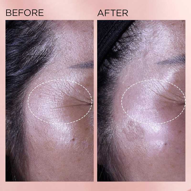 Elizabeth Arden Retinol + HPR Ceramide Rapid Skin Renewing Anti-Aging Face Serum Capsules, Fine Lines & Wrinkles Treatment with Peptides, Vitamin E, & Niacinamide14 Elizabeth Arden Retinol + HPR Ceramide Rapid Skin Renewing Anti-Aging Face Serum Capsules, Fine Lines & Wrinkles Treatment with Peptides, Vitamin E, & Niacinamide