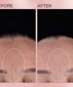 Elizabeth Arden Retinol + HPR Ceramide Rapid Skin Renewing Anti-Aging Face Serum Capsules, Fine Lines & Wrinkles Treatment with Peptides, Vitamin E, & Niacinamide15