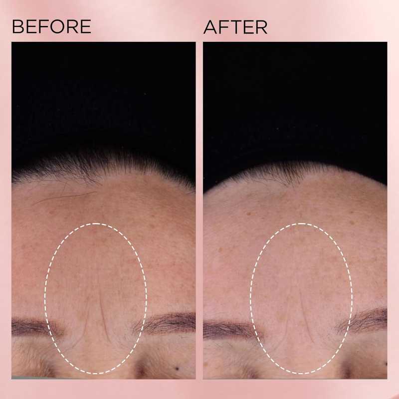 Elizabeth Arden Retinol + HPR Ceramide Rapid Skin Renewing Anti-Aging Face Serum Capsules, Fine Lines & Wrinkles Treatment with Peptides, Vitamin E, & Niacinamide6 Elizabeth Arden Retinol + HPR Ceramide Rapid Skin Renewing Anti-Aging Face Serum Capsules, Fine Lines & Wrinkles Treatment with Peptides, Vitamin E, & Niacinamide15